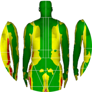 dexa_body_composition | Live Lean Rx Houston